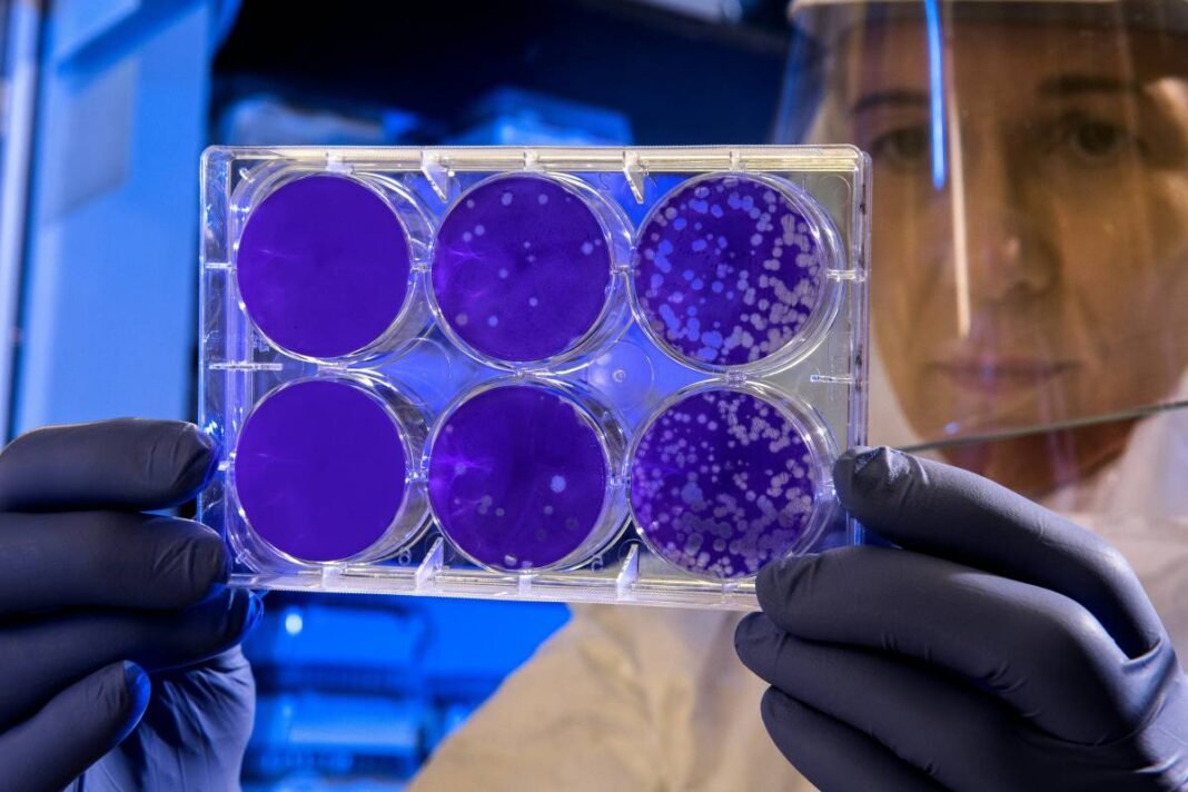 Legionnaires’ disease outbreak reported in southwestern Ontario