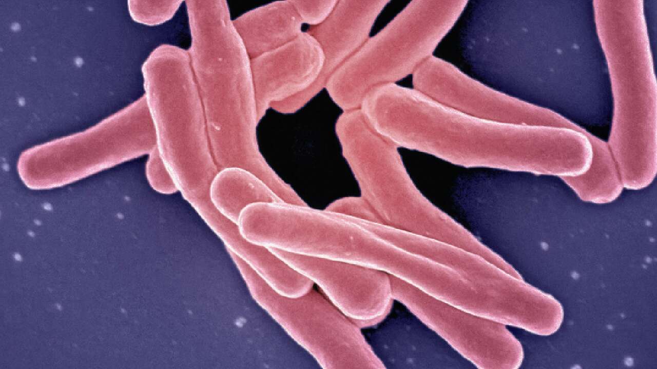 Nine cases confirmed in legionnaires' disease outbreak in Toronto: health unit 