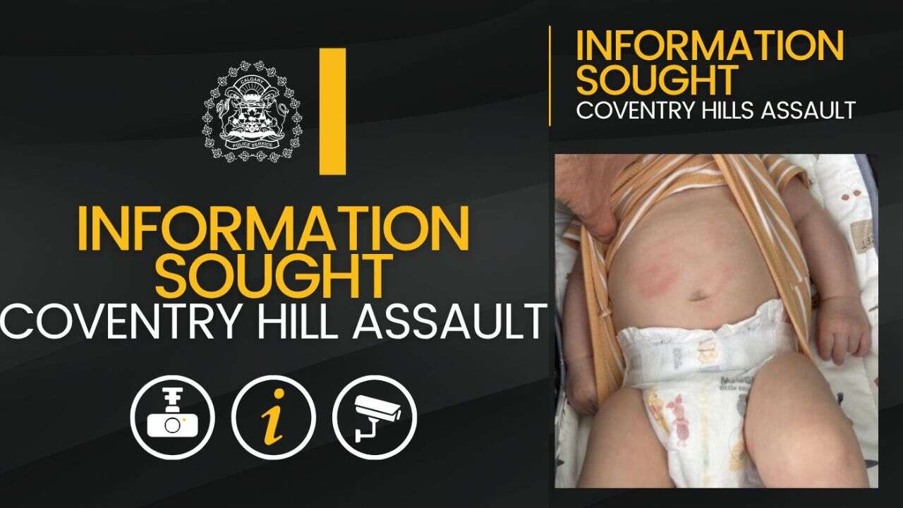 Calgary police search for youth after 9-week-old baby assaulted