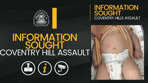 Calgary police search for youth after 9-week-old baby assaulted