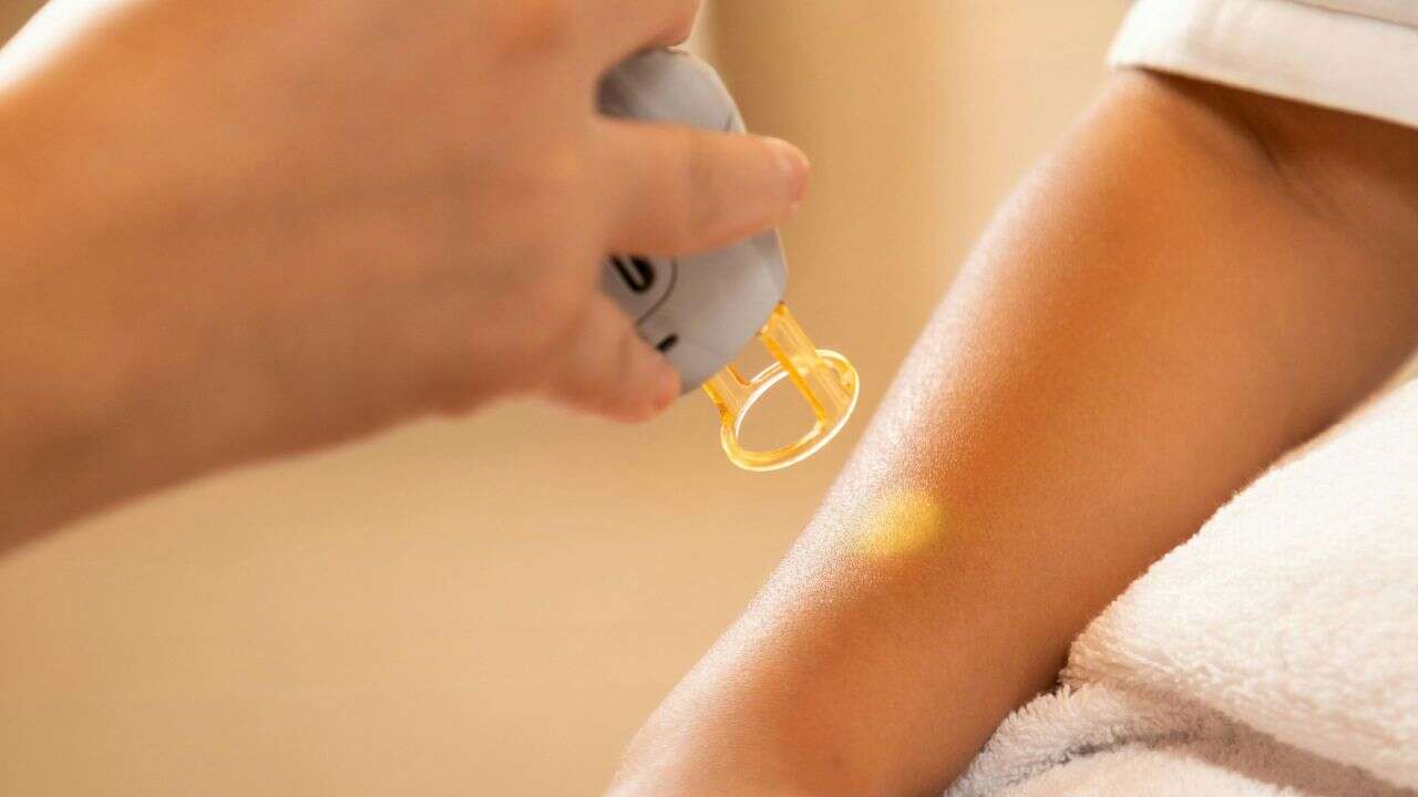Melanoma cases rising in Alberta