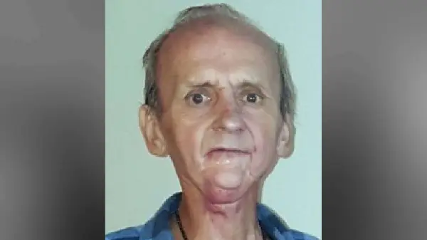 Toronto Police Seek Help Locating Missing 69-Year-Old