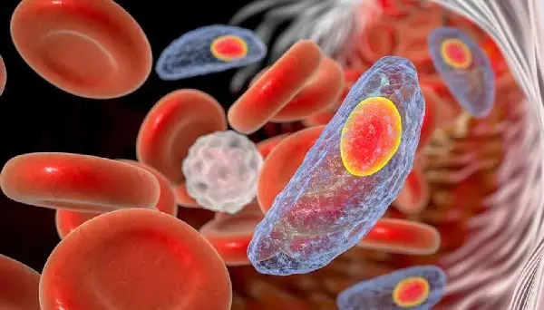 Alberta investigates rise in parasitic Illness as six cases confirmed