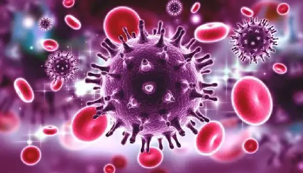 Alberta HIV experts warn of potential rise in infections amid global funding cuts